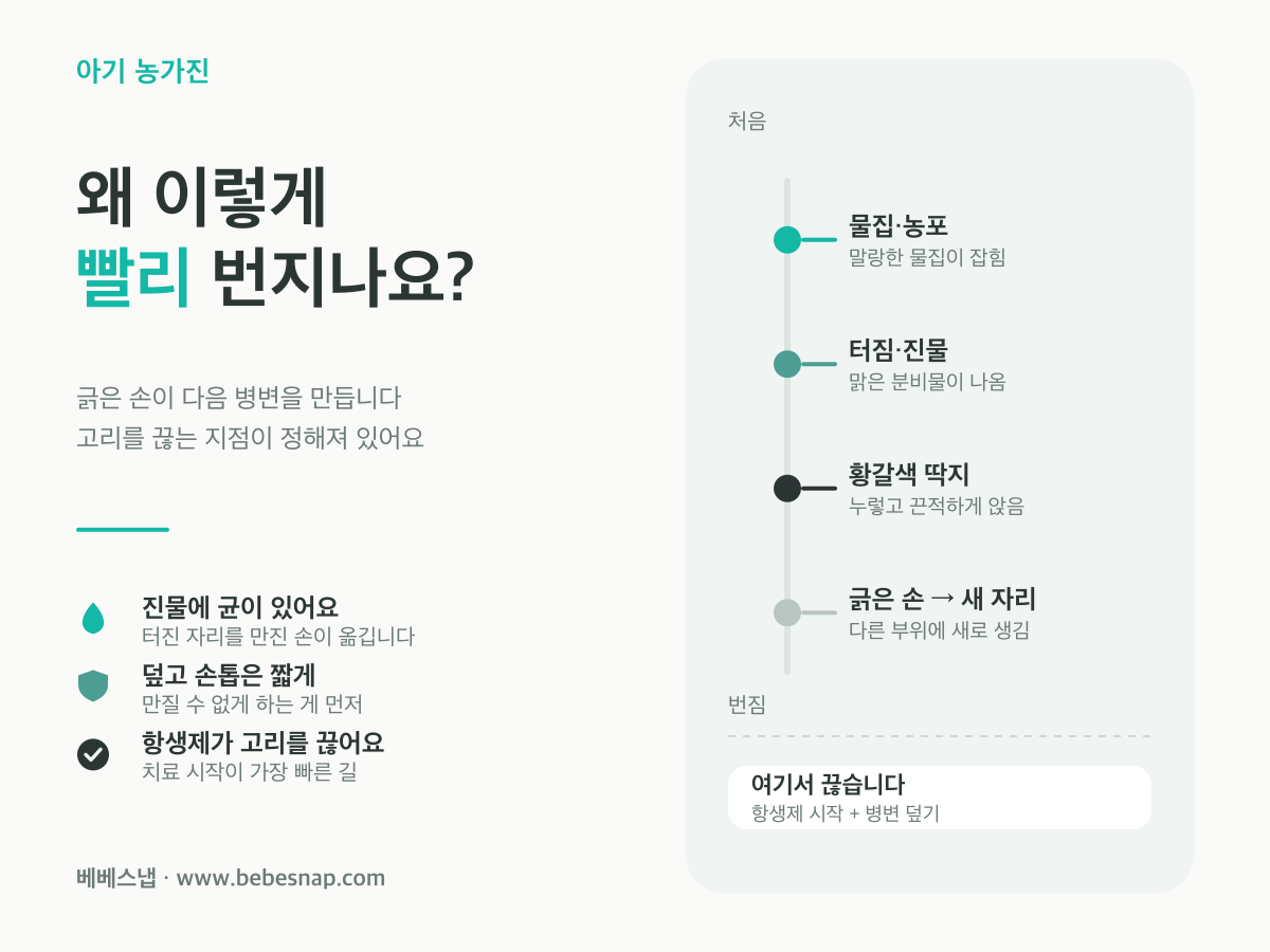 아기 농가진 번지는 과정 - 물집에서 진물, 황갈색 딱지, 긁은 손으로 새 부위에 옮는 순서 도식